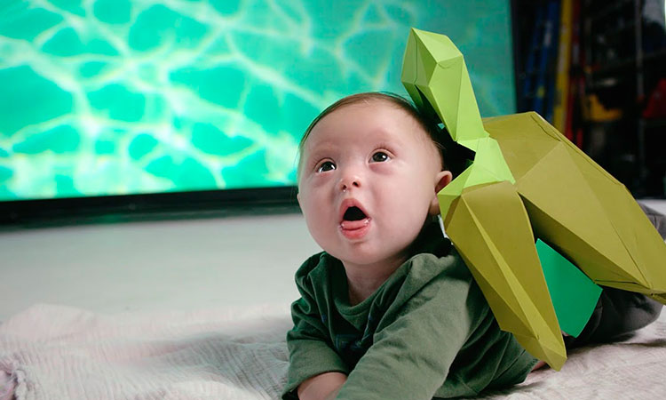 Campaña de síndrome de Down