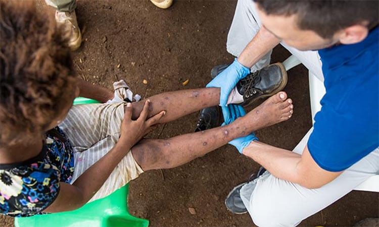 Casas en pobreza / Pobreza en África