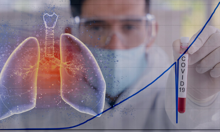 Casos de influenza y COVID-19